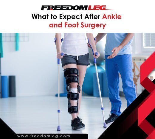 What to Expect After Ankle and Foot Surgery