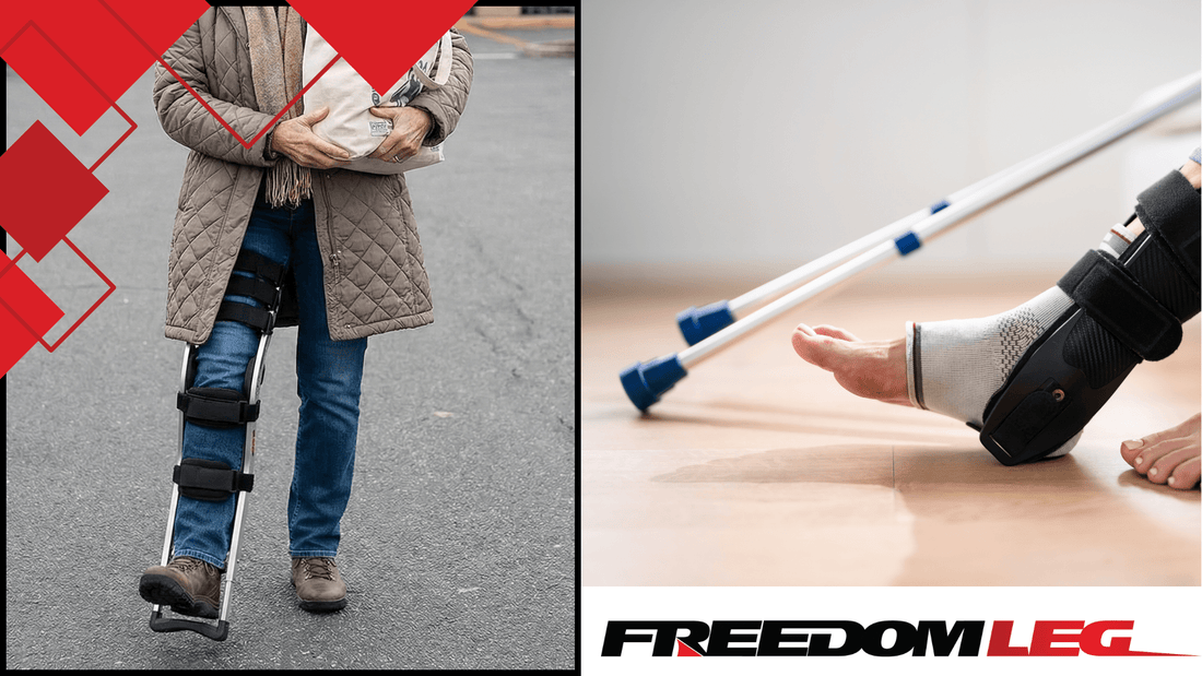 Best Crutches for Ankle Surgery (and Why You May Not Need Them)